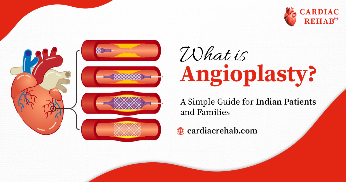 What is Angioplasty? A Simple Guide for Indian Patients and Families